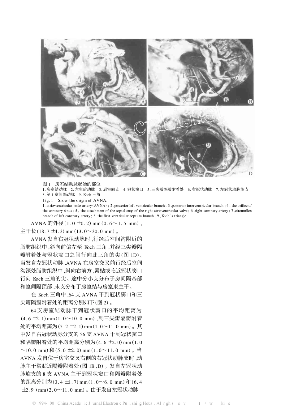 房室结动脉的应用解剖_第2页