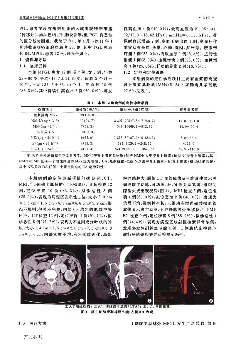 恶性副神经节瘤的诊治探讨_第2页