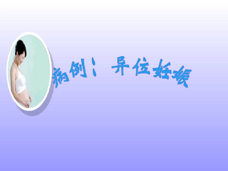 异位妊娠病例讨论ppt_第1页