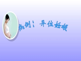 异位妊娠病例讨论ppt