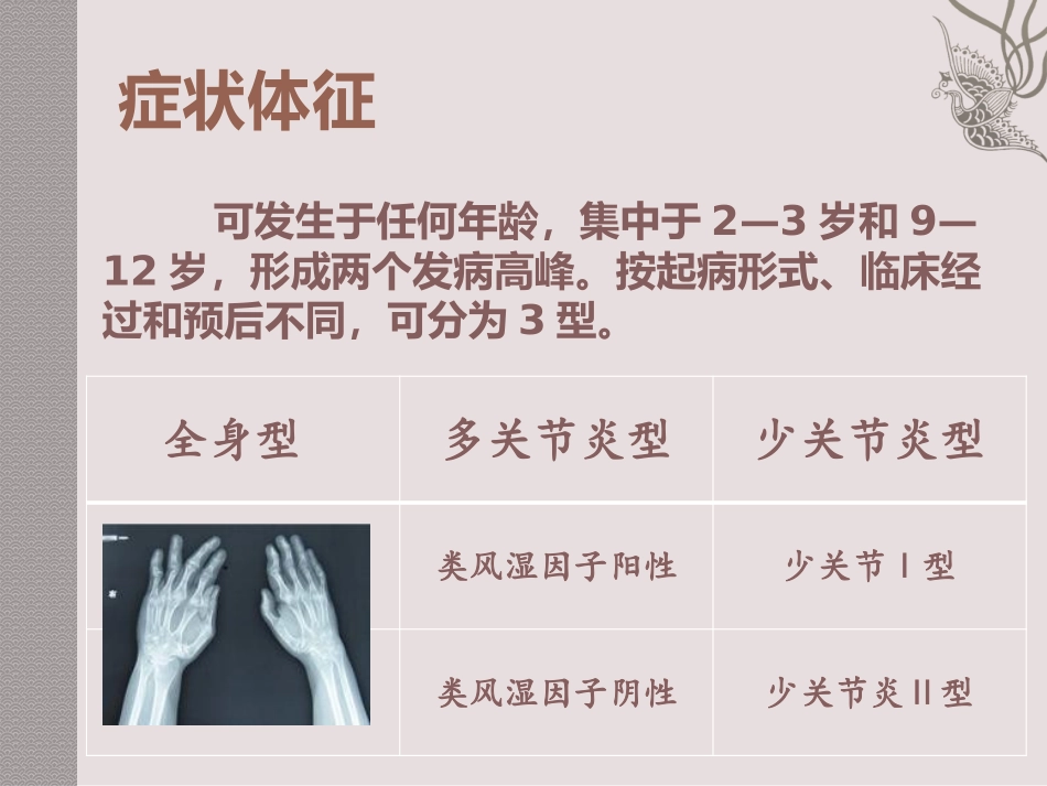 幼年性类风湿性关节炎_第3页