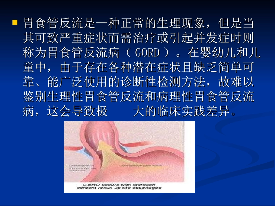 婴幼儿胃食管反流病_第2页