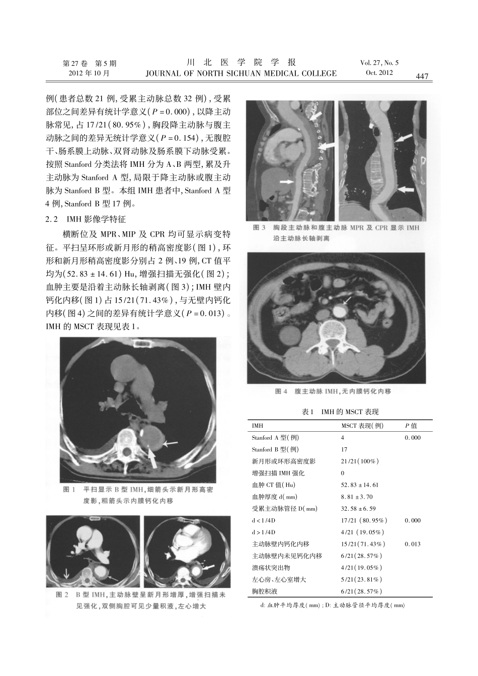 多层螺旋CT血管成像对主动脉壁内血肿的诊断价值.kdh_第3页