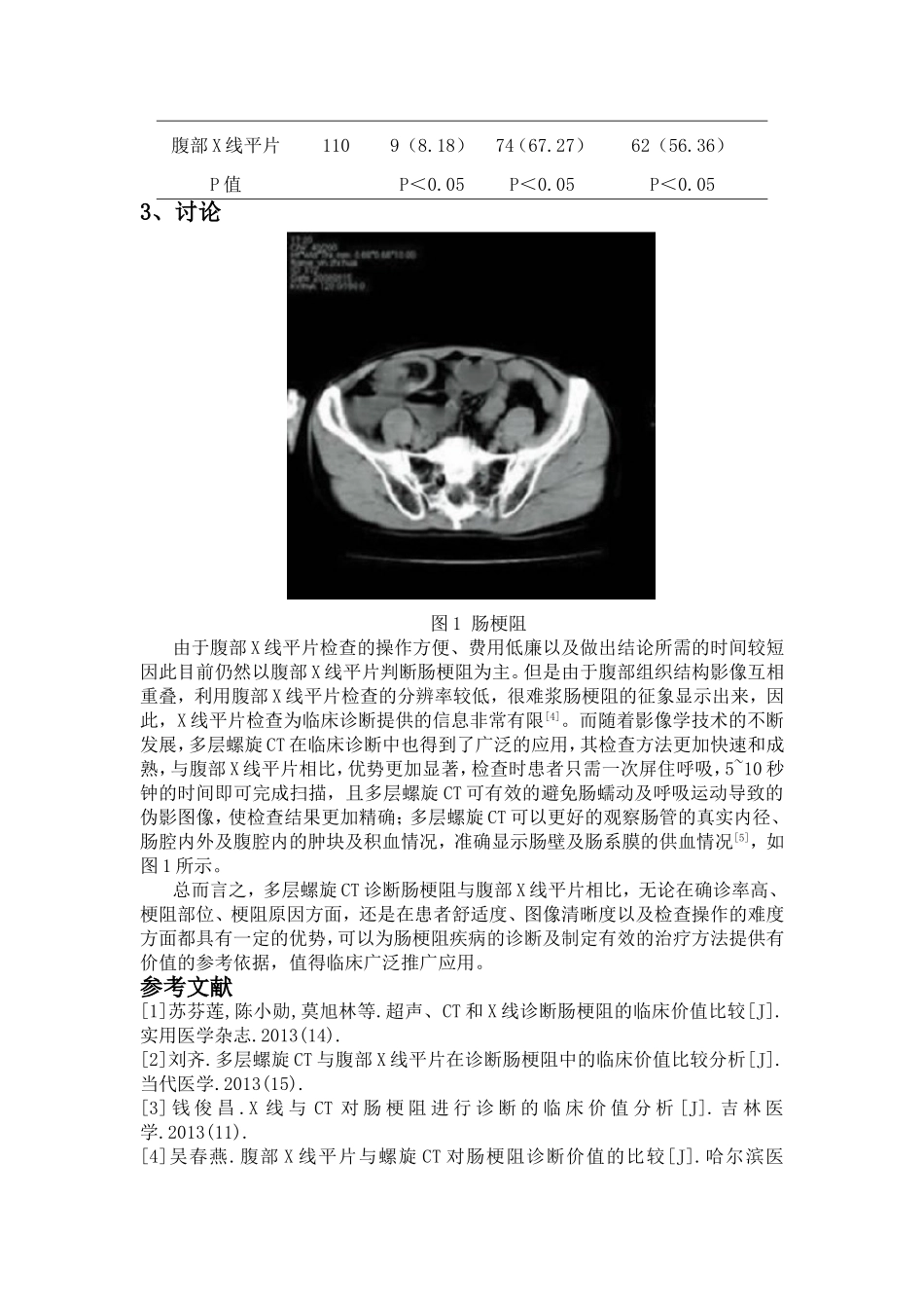 多层螺旋CT、腹部X线平片在诊断肠梗阻中的临床价值比较分析_第3页