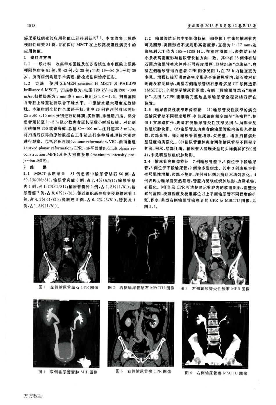 多层螺旋CT在上尿路梗阻性病变中的应用价值_第2页