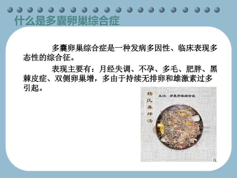 多囊性卵巢怎么治疗_第2页