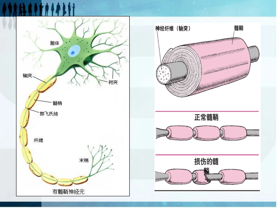 多发性硬化的护理_第3页