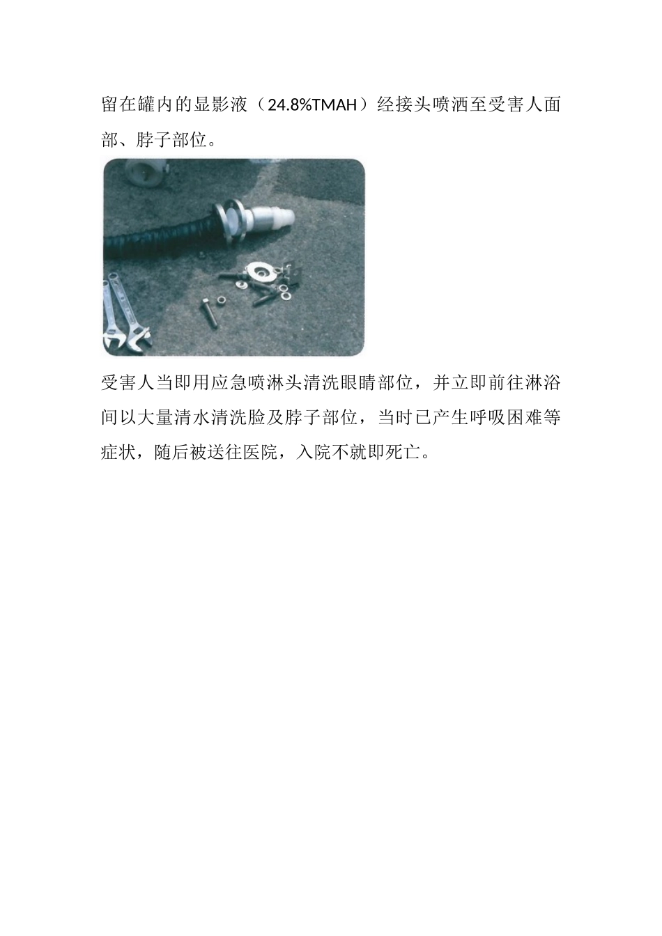 因TMAH引发的职业病案例_第2页