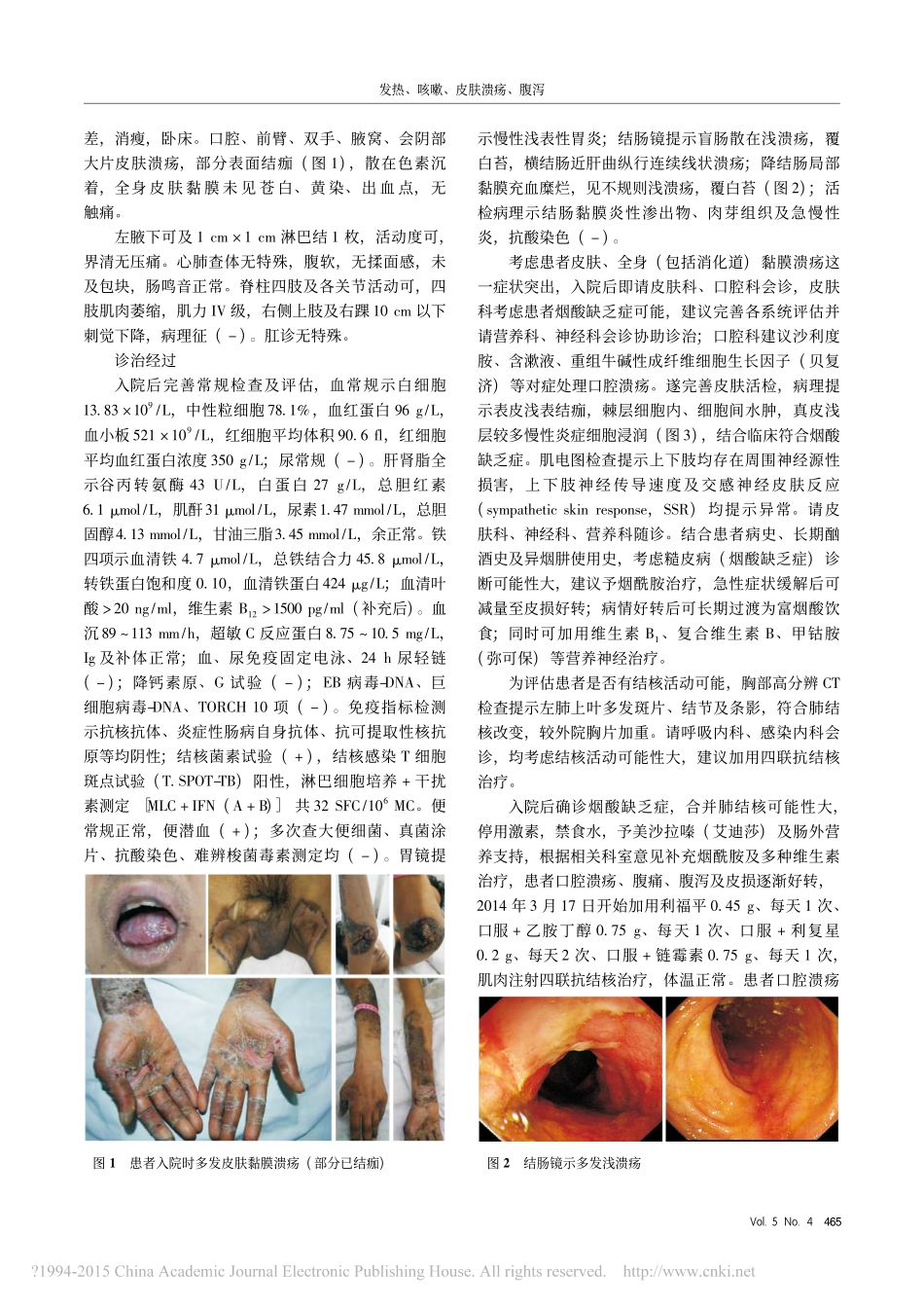 发热_咳嗽_皮肤溃疡_腹泻_第2页