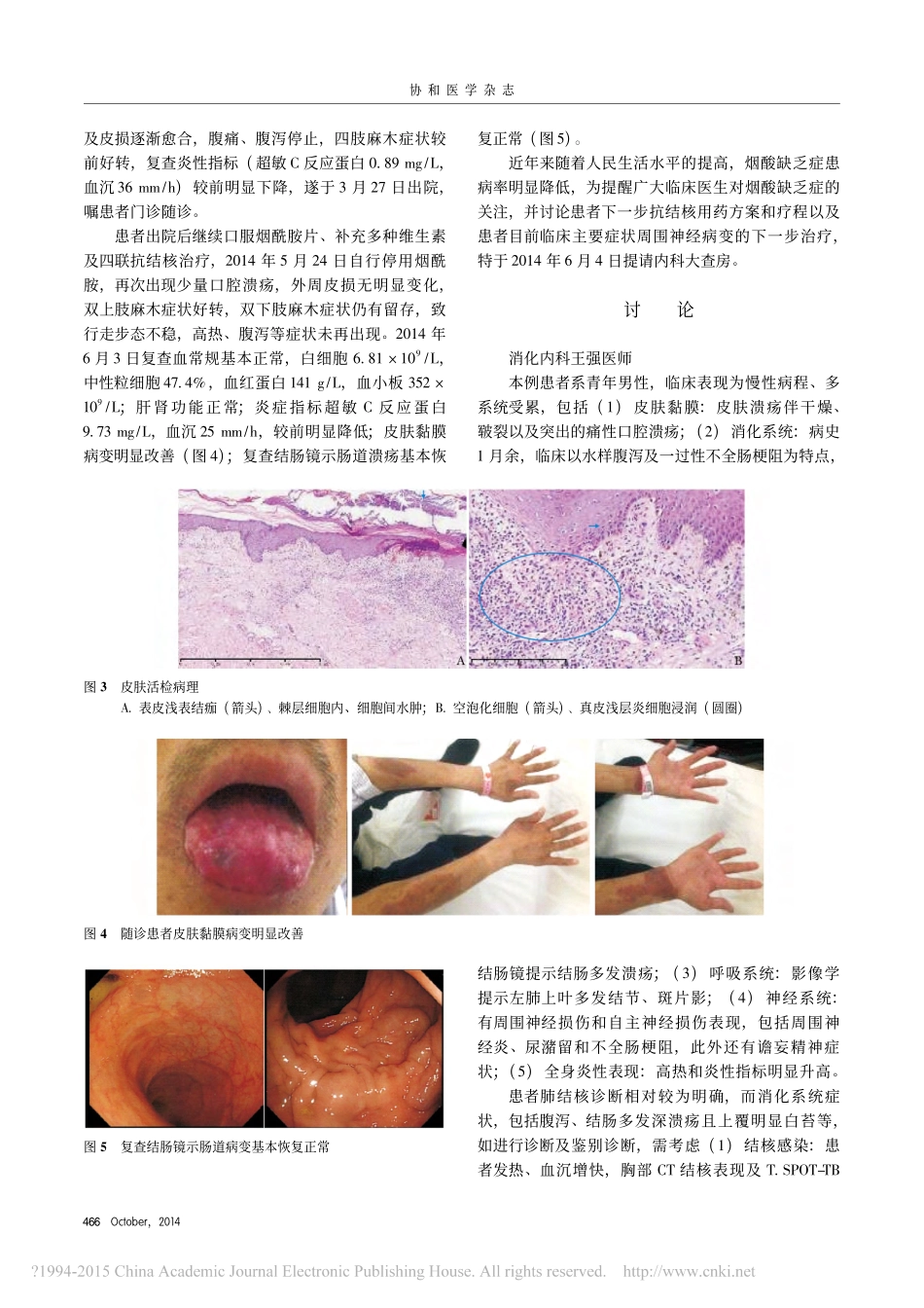 发热_咳嗽_皮肤溃疡_腹泻_第3页