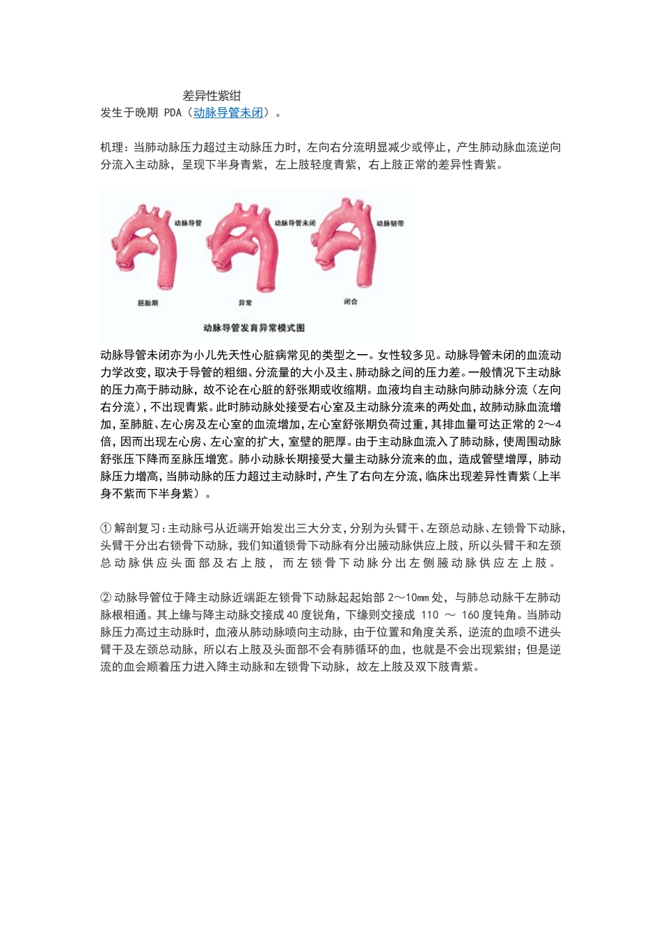 动脉导管未闭_第1页