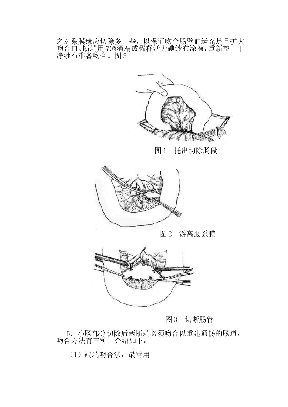 动物肠切除肠吻合术_第3页