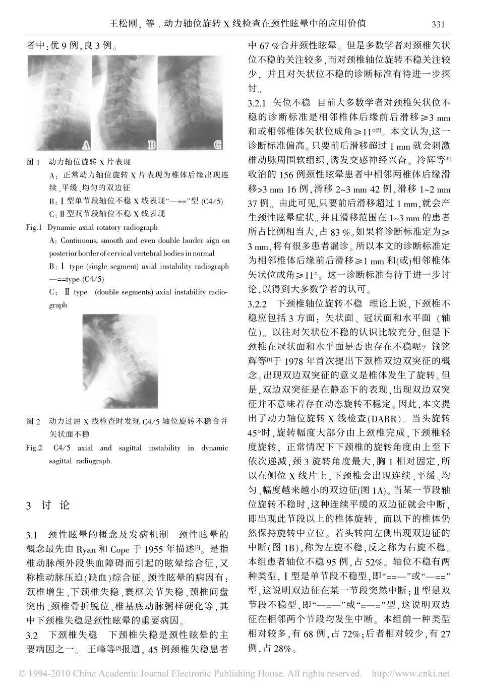 动力轴位旋转X线检查在颈性眩晕中的应用价值_第3页