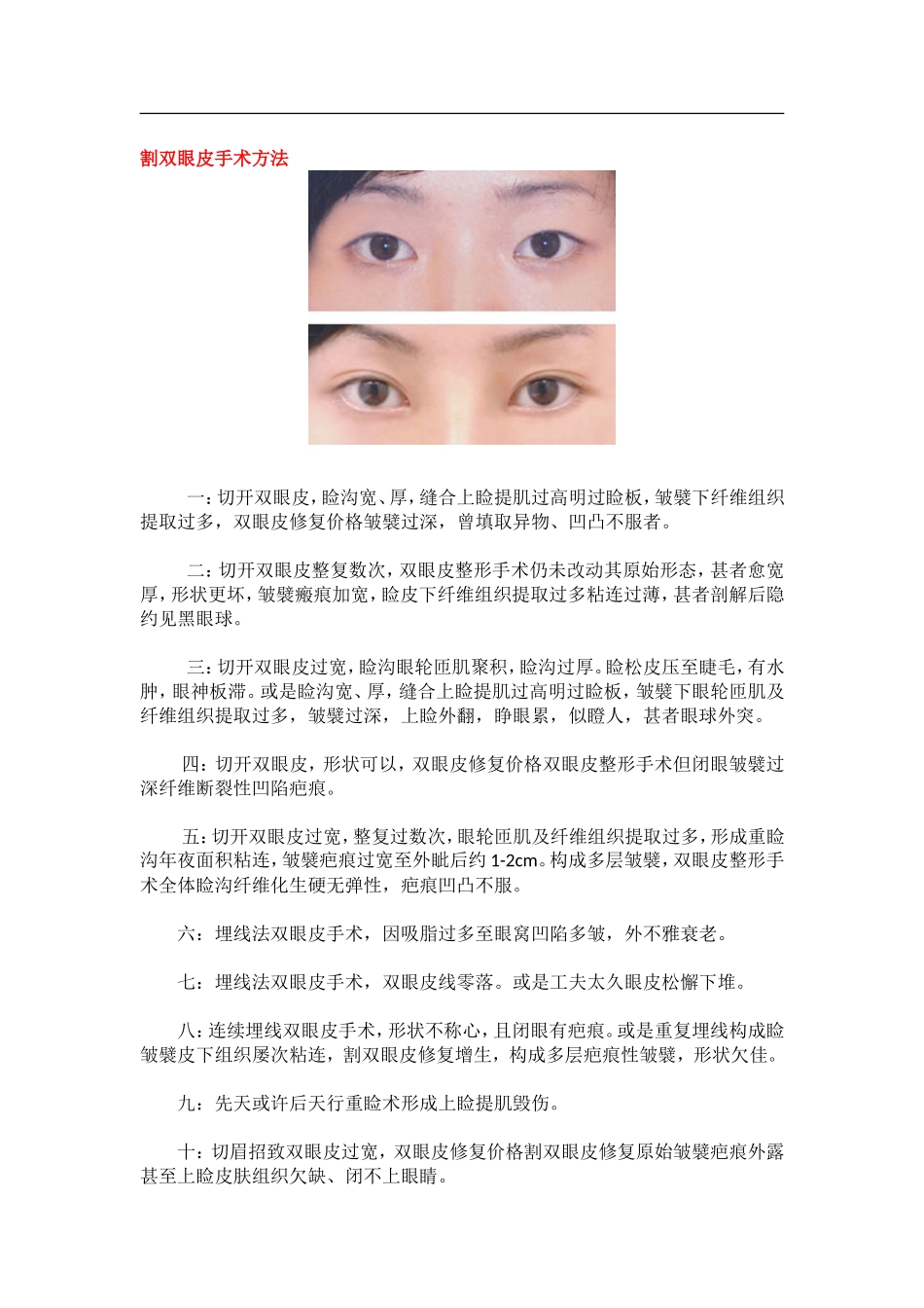 分析割双眼皮疼不疼_第1页