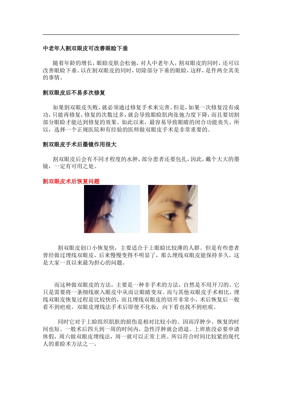 分析割双眼皮疼不疼_第3页