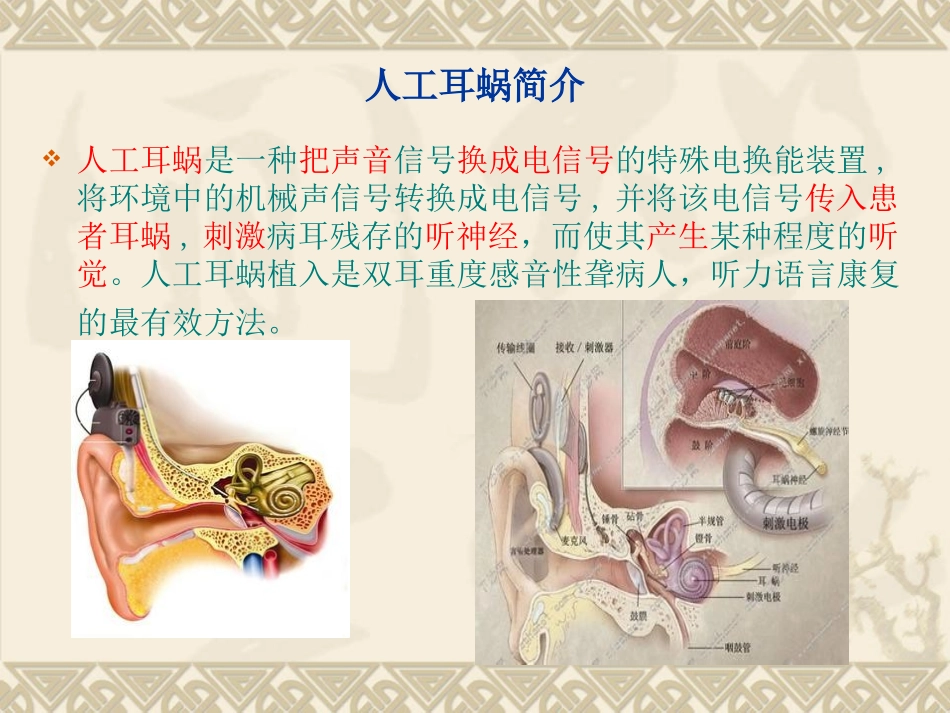 儿童人工耳蜗植入术的简介及麻醉要点-赵献亮_第2页