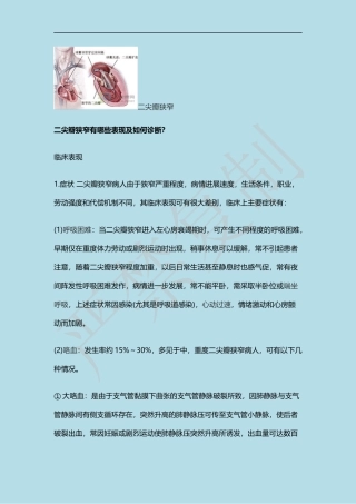二尖瓣狭窄有哪些表现及如何诊治