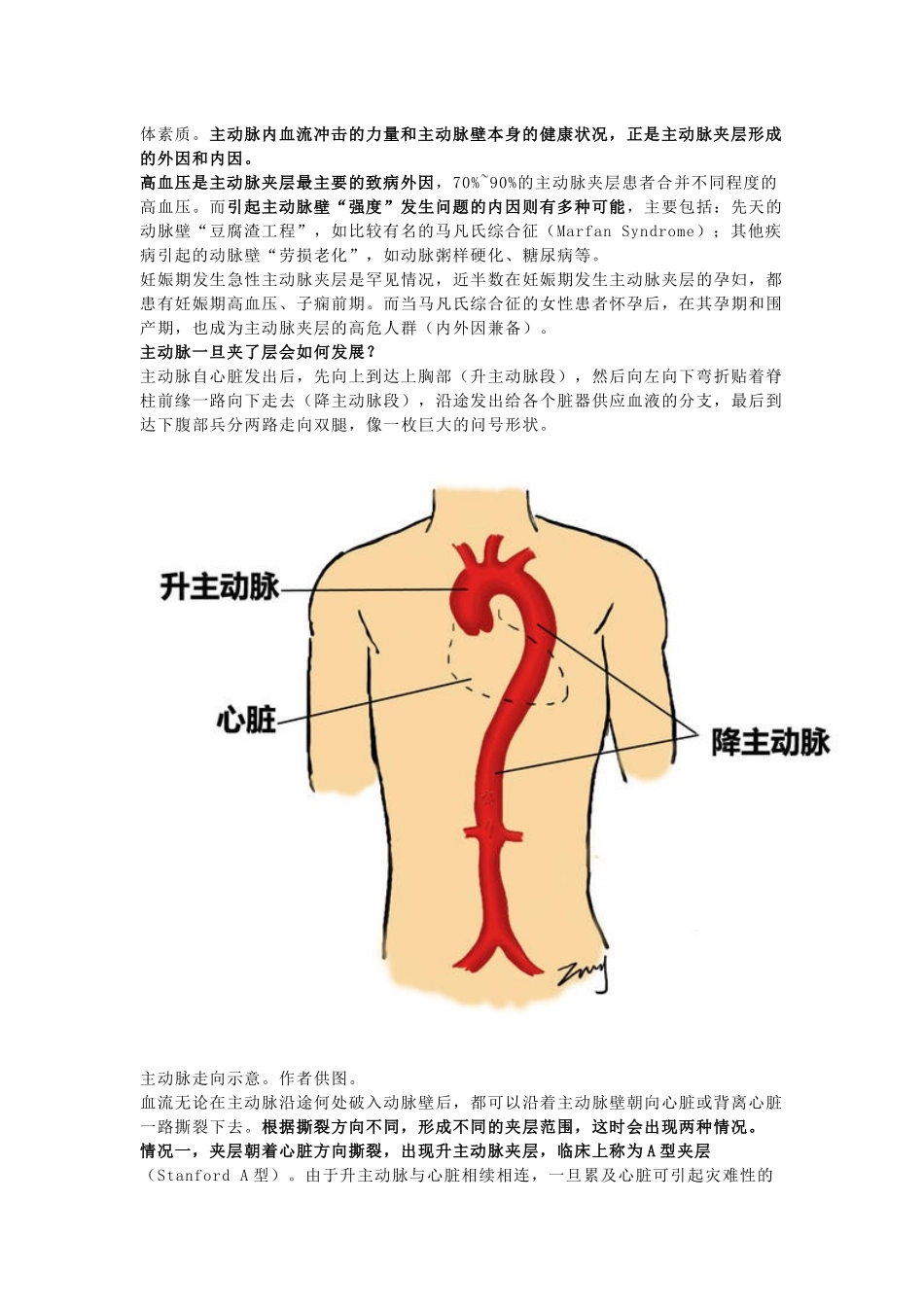 主动脉夹层是什么病？有多危险？_第2页
