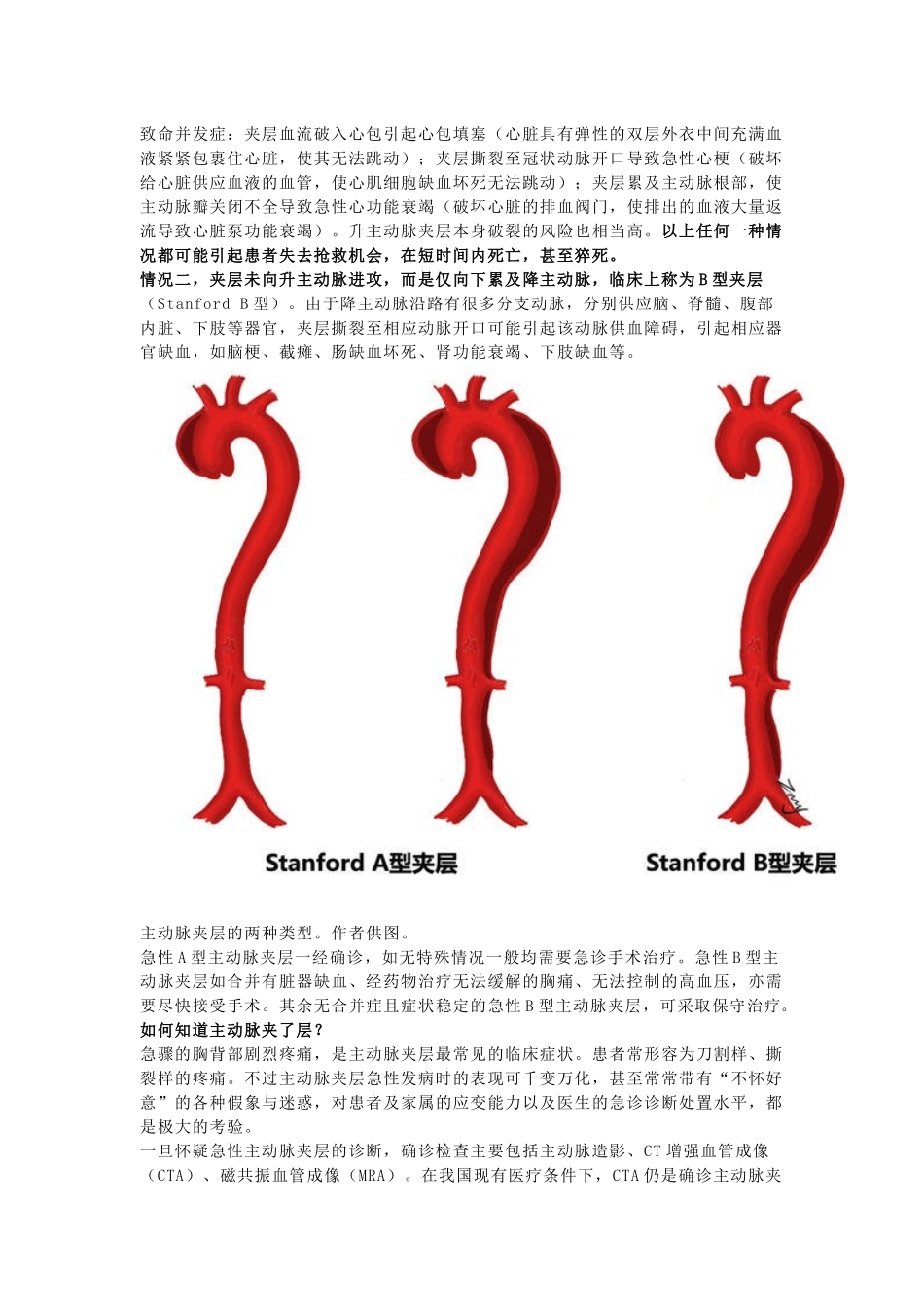 主动脉夹层是什么病？有多危险？_第3页
