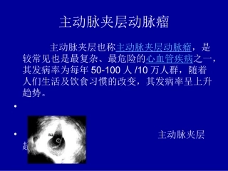 主动脉夹层动脉瘤刘崇新