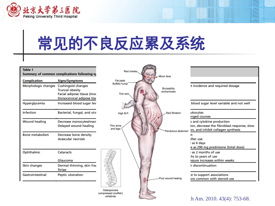 糖皮质激素不良反应概述北医三院_第3页