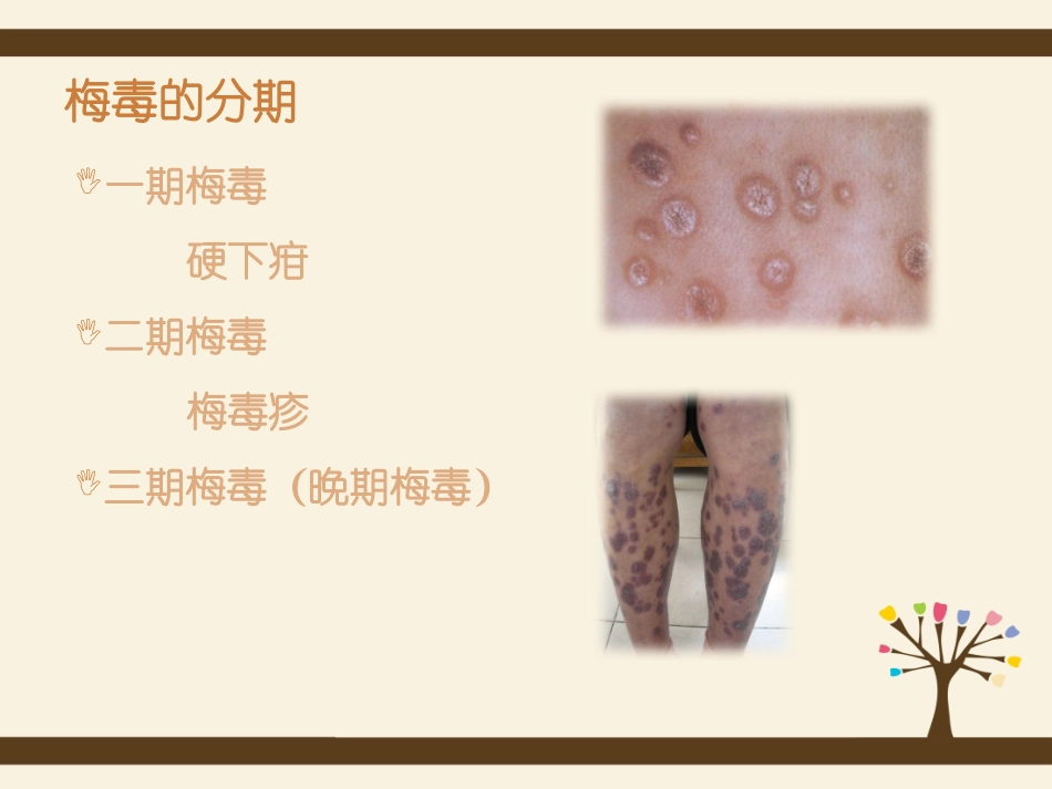 梅毒的流行与防治措施_第3页