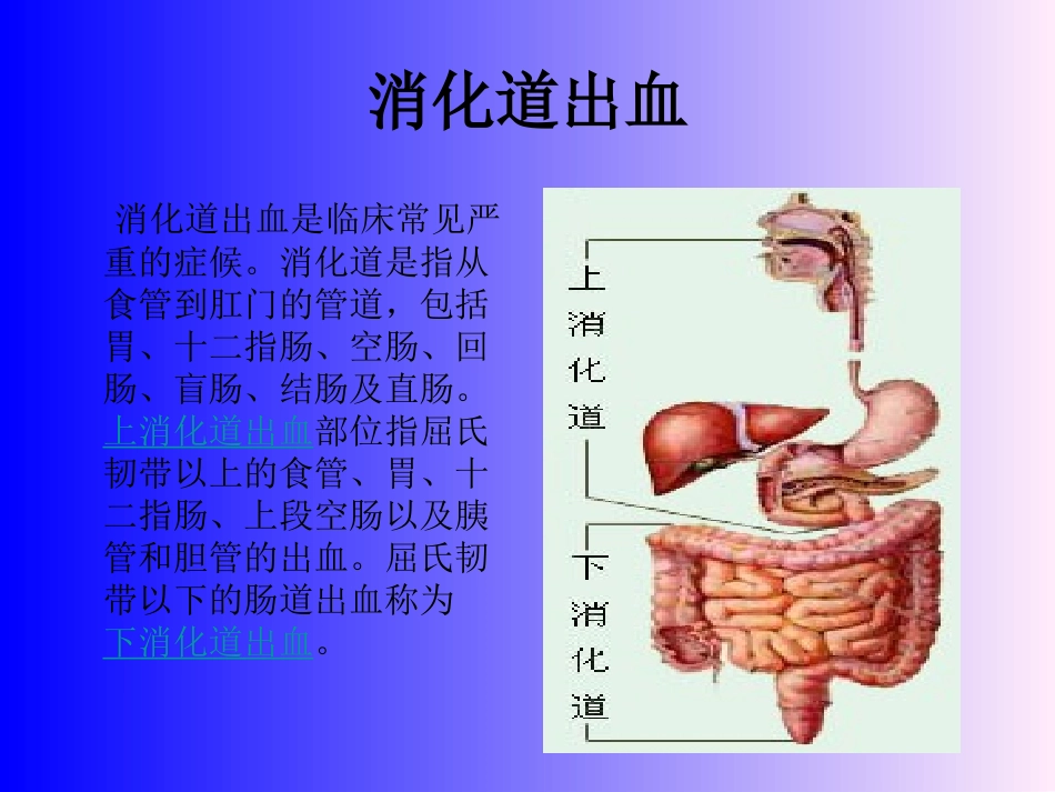 上消化道出血3_第2页