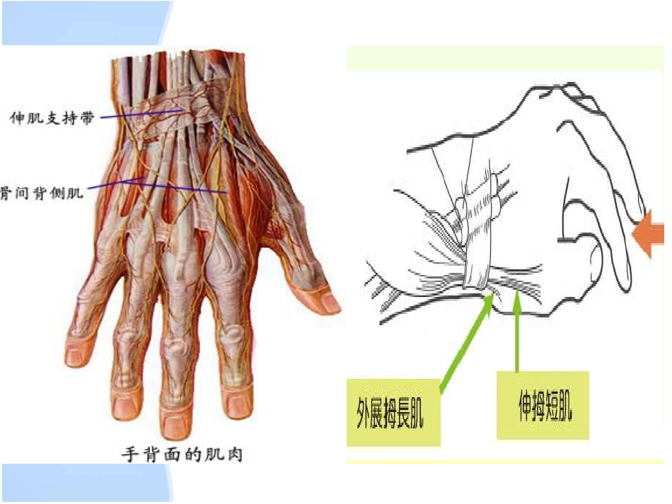 挠骨茎突狭窄性腱鞘炎_第3页
