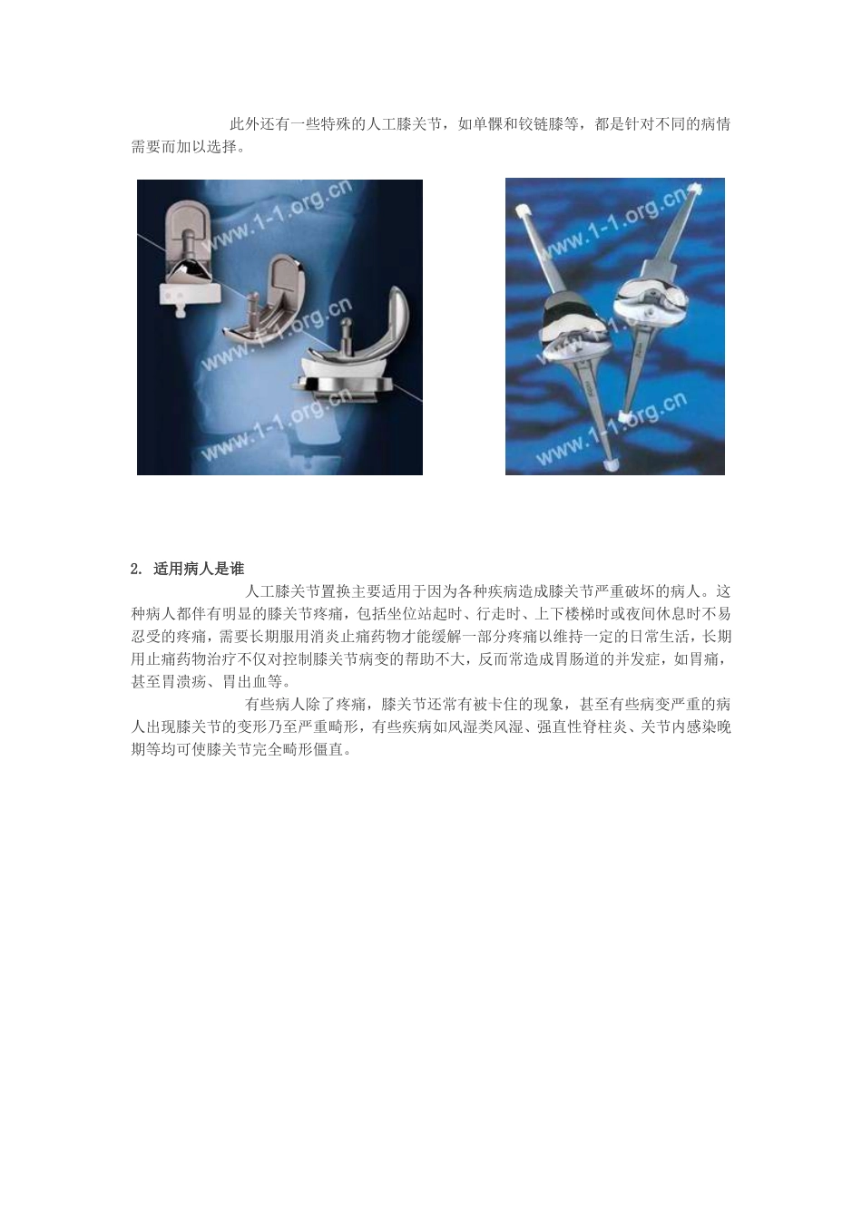 人工膝关节置换术后康复指南_第2页