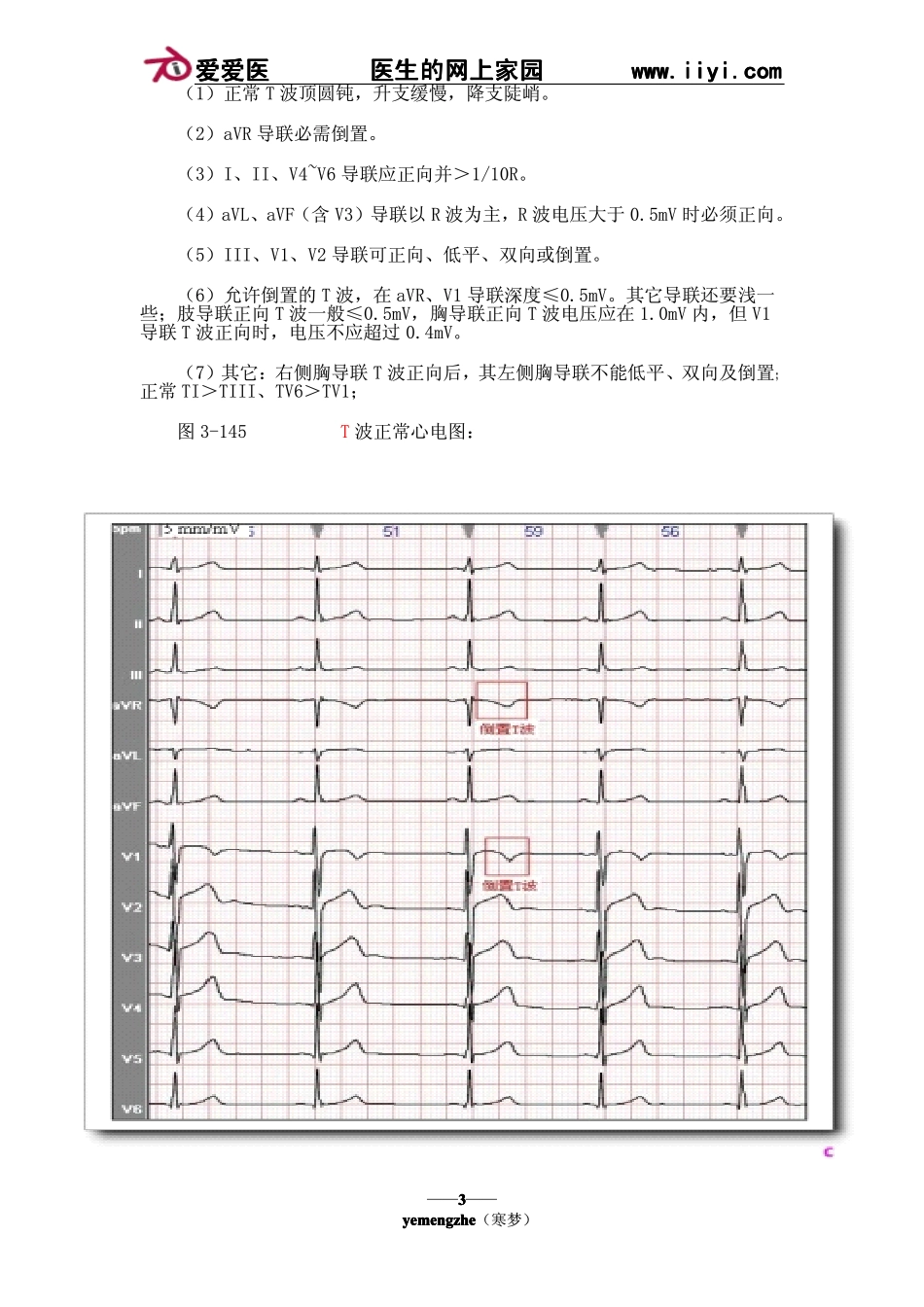 (十一)T波分析_第3页