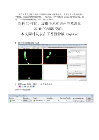 mimics手术导板制作-简单易行