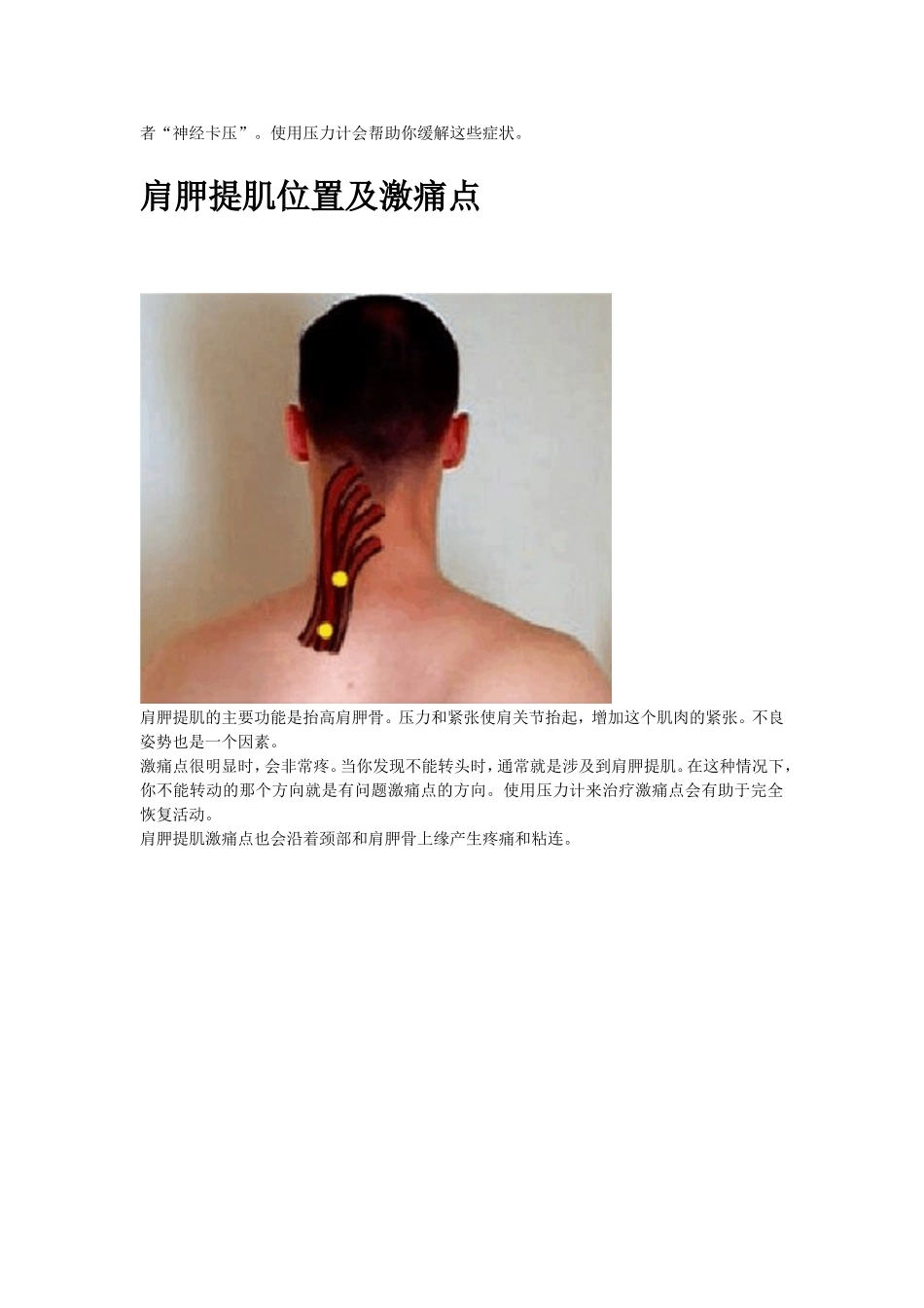 2012520128张明镇常见肌肉的激痛点_第2页