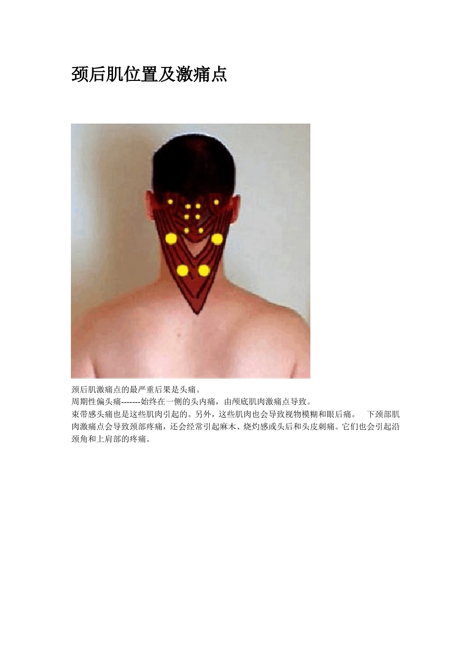 2012520128张明镇常见肌肉的激痛点_第3页