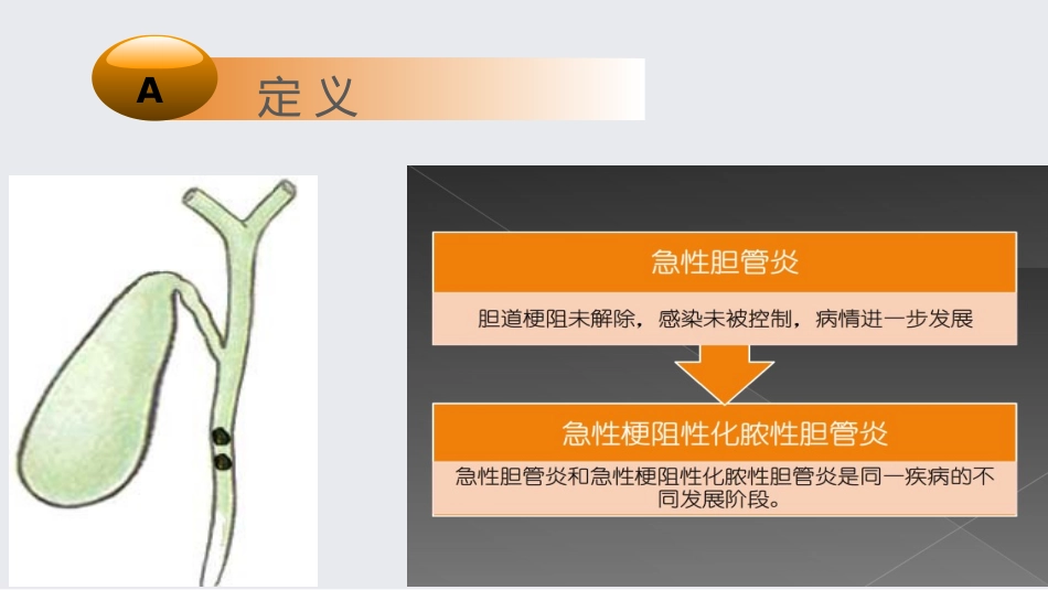 急性梗阻化脓胆管炎_第3页