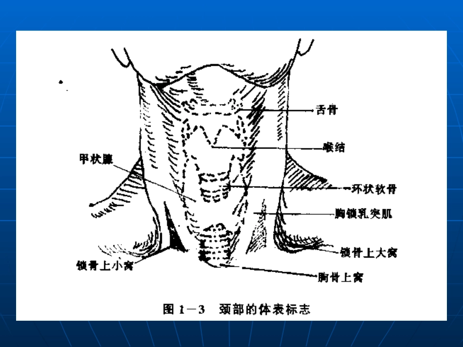 锁骨下深静脉穿刺_第3页