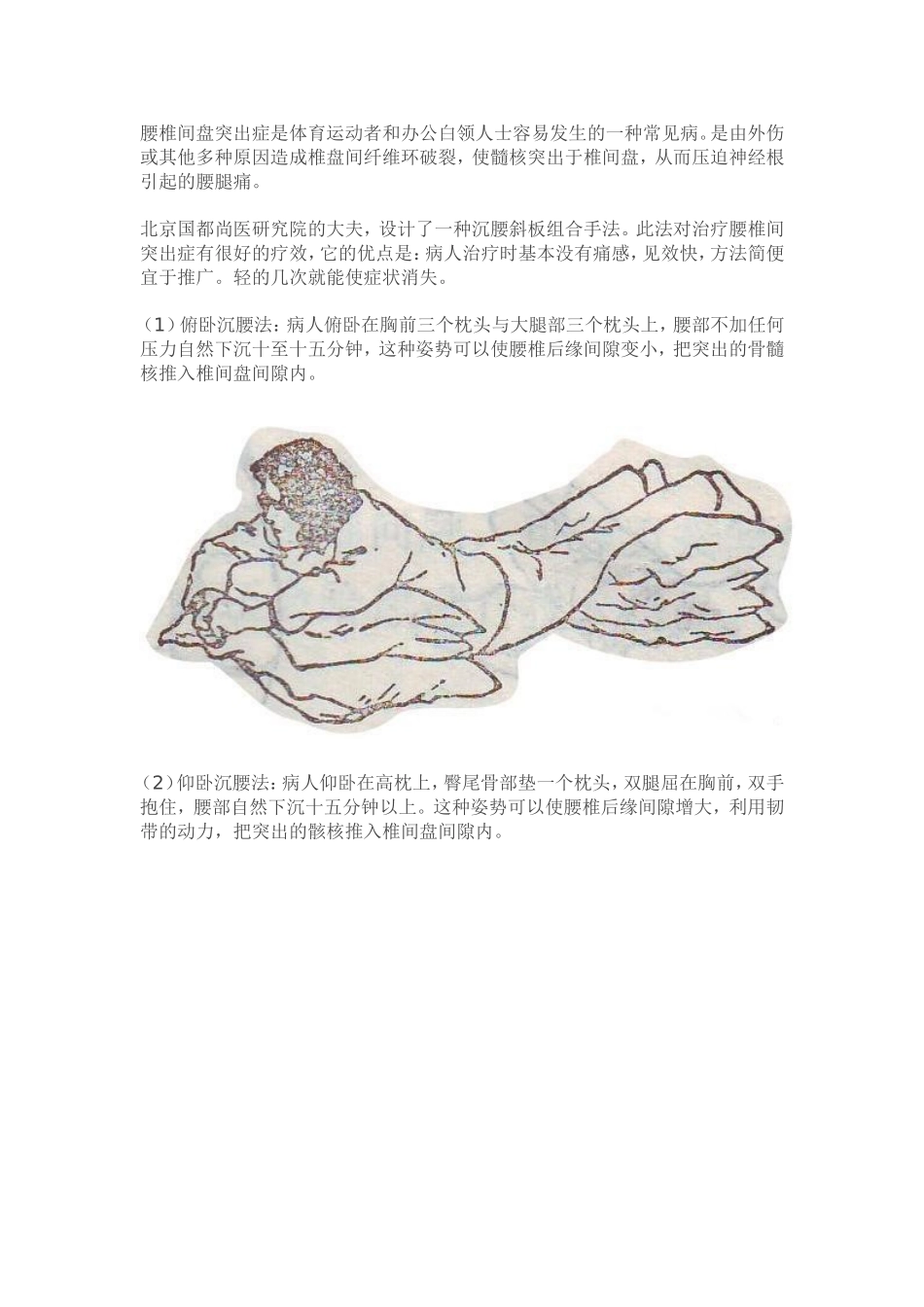 腰间盘突出症不花钱_第2页