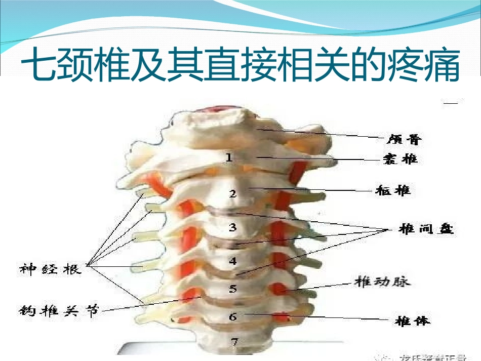七颈椎及其直接相关的疼痛_第1页