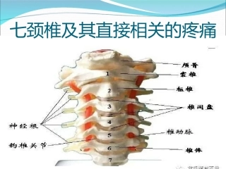 七颈椎及其直接相关的疼痛