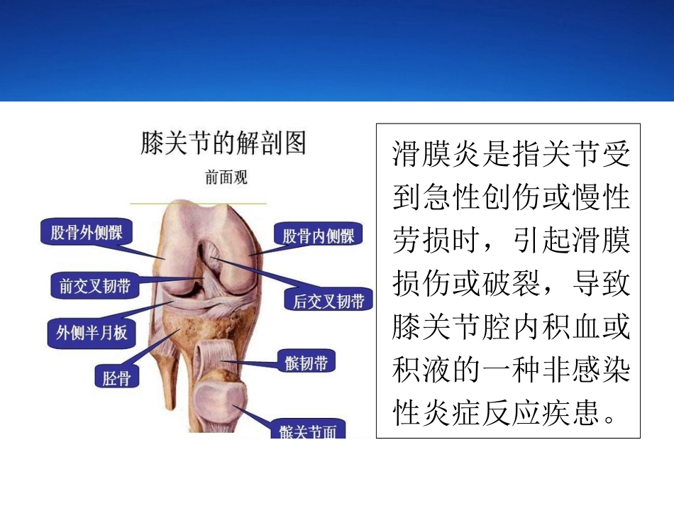 滑膜炎症状汇编_第2页