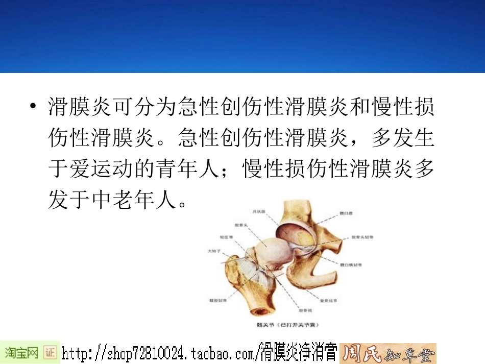 滑膜炎症状汇编_第3页
