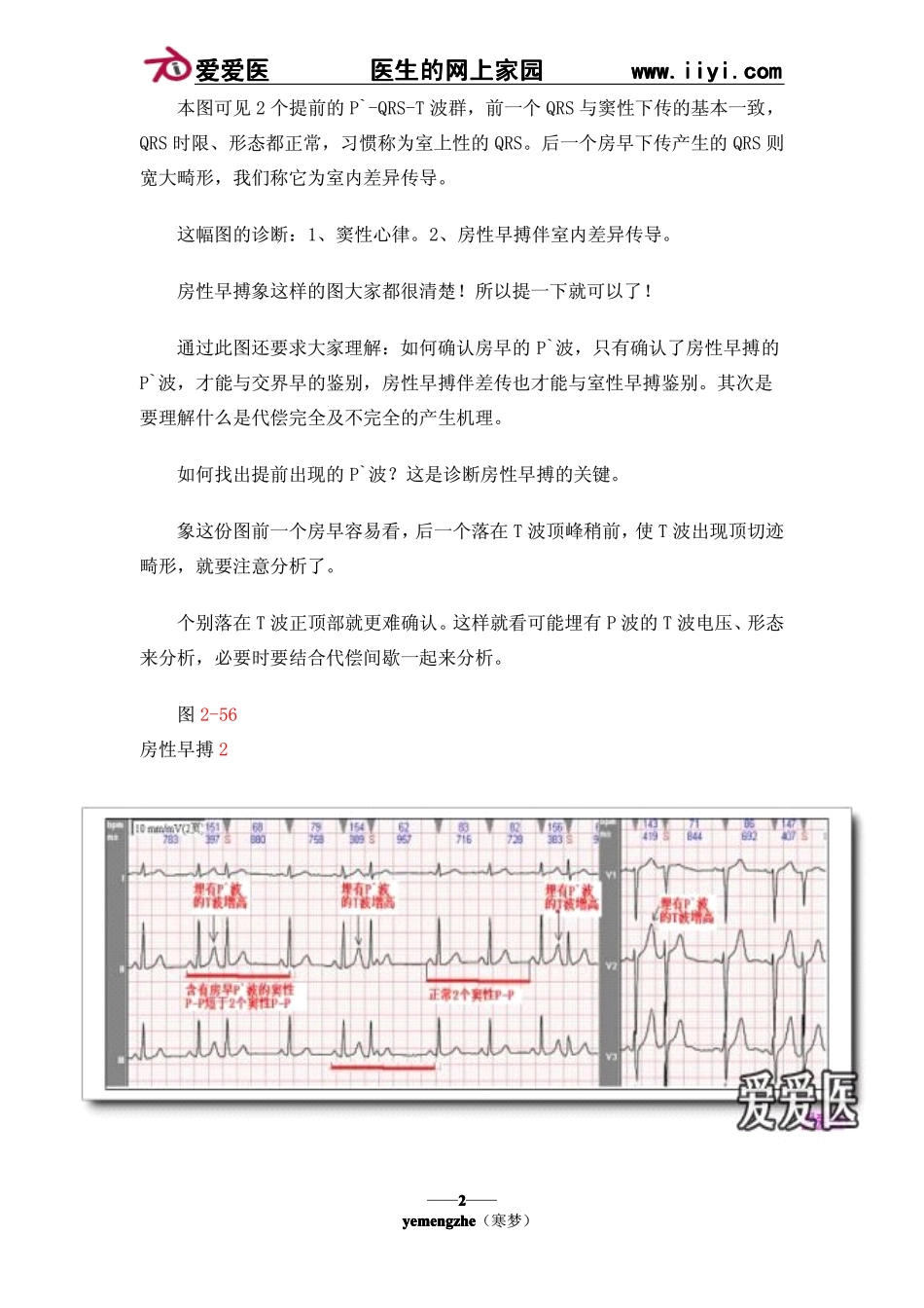 (十五)房性心律失常_第2页