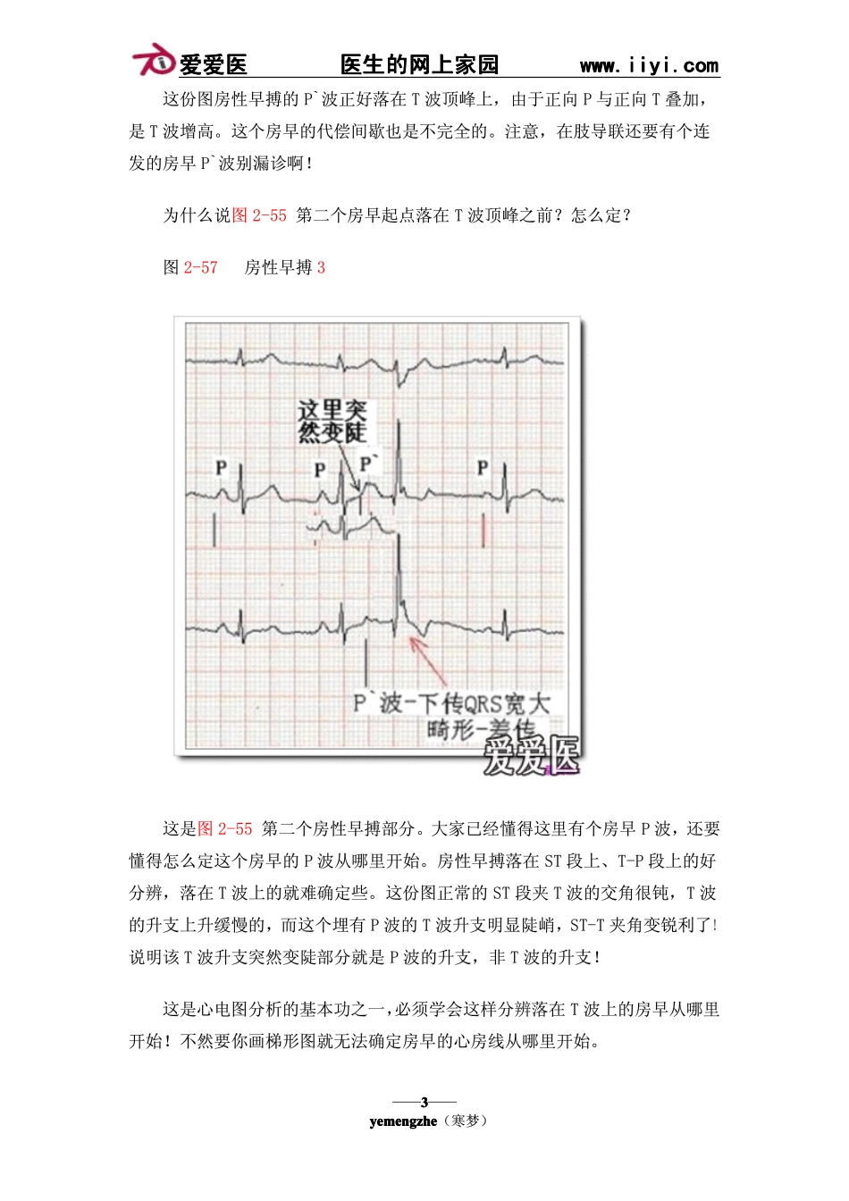 (十五)房性心律失常_第3页