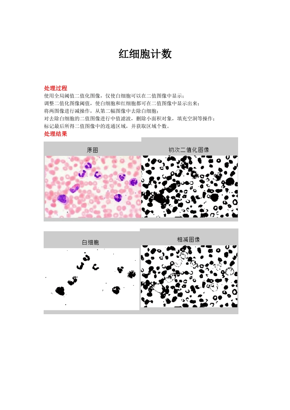 图像处理—红细胞计数(Matlab)_第1页