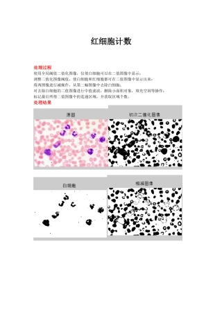 图像处理—红细胞计数(Matlab)