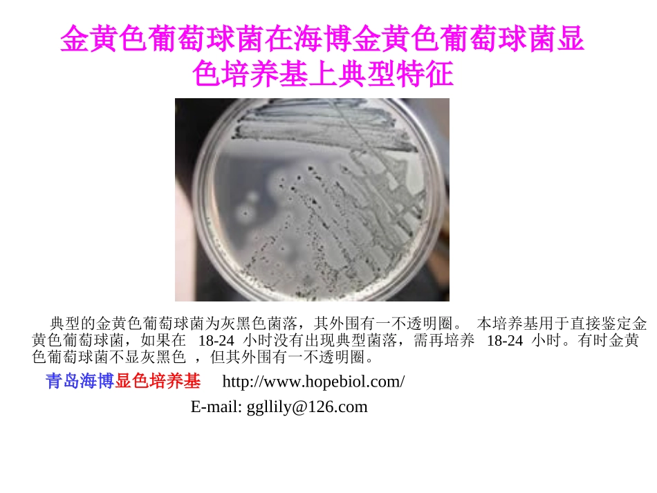 大肠杆菌在海博大肠杆菌大肠菌群显色培养基---关重点_第2页