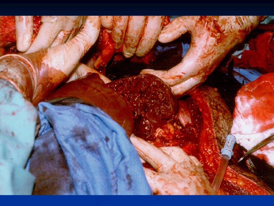 创伤性出血的控制_第2页