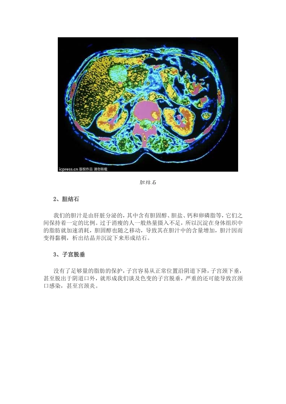 女人太苗条易得10种病_第2页