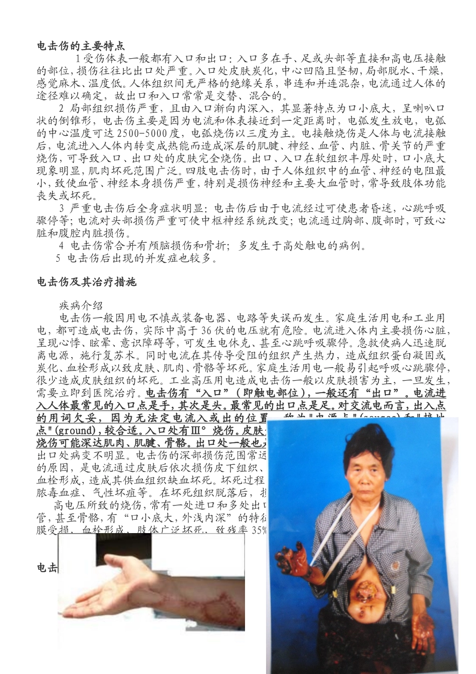 电击伤的主要特点_第1页