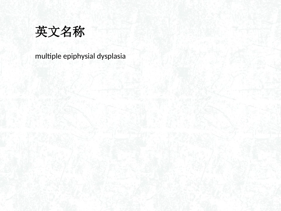 多发性骨骺发育不良概述_第2页