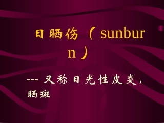 日晒伤(sunburn)要点